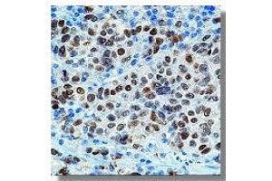 Immunohistochemistry (IHC) image for anti-Microphthalmia-Associated Transcription Factor (MITF) antibody (ABIN264430) (MITF antibody)