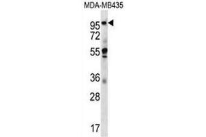 CTAGE5 Antibody (C-term) western blot analysis in MDA-MB435 cell line lysates (35µg/lane). (MIA2 antibody  (C-Term))