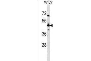 Western Blotting (WB) image for anti-N-Myc (And STAT) Interactor (NMI) antibody (ABIN3000888) (NMI antibody)