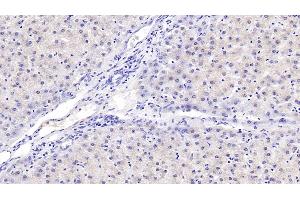 Detection of aHSP in Human Liver Tissue using Monoclonal Antibody to Alpha-Hemoglobin Stabilizing Protein (aHSP) (aHSP antibody  (AA 1-102))