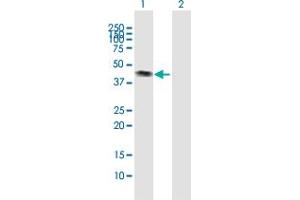Western Blot analysis of CALR3 expression in transfected 293T cell line by CALR3 MaxPab polyclonal antibody. (Calreticulin 3 antibody  (AA 1-384))