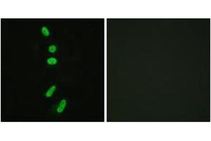Immunofluorescence analysis of HeLa cells, using SF1 (Ab-82) Antibody. (Splicing Factor 1 antibody  (AA 48-97))