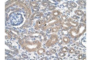 SLC12A1 antibody was used for immunohistochemistry at a concentration of 4-8 ug/ml to stain Epithelial cells of renal tubule (arrows) in Human Kidney.
