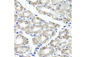 Immunohistochemistry of paraffin-embedded human stomach using MAPKBP1 antibody (ABIN5971432) at dilution of 1/100 (40x lens). (MAPKBP1 antibody)