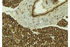 ABIN6279403 at 1/100 staining Mouse pancreas tissue by IHC-P. (UBR2 antibody  (C-Term))