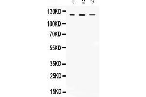 Western blot analysis of CIITA expression in rat thymus extract ( Lane 1), mouse thymus extract ( Lane 2) and MCF-7 whole cell lysates ( Lane 3). (CIITA antibody  (AA 945-1130))