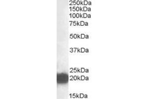 Image no. 1 for anti-Cysteine and Glycine-Rich Protein 3 (CSRP3) (Internal Region) antibody (ABIN375064) (CSRP3 antibody  (Internal Region))