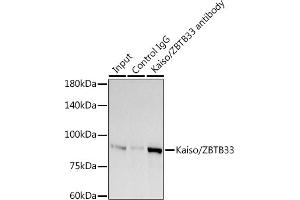 Immunoprecipitation analysis of 300 μg extracts of A-549 cells using 3 μg Kaiso/ZBTB33 antibody (ABIN7271437). (ZBTB33 antibody)