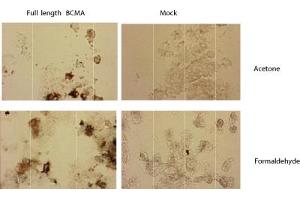 Immunostaining of HEK 293 cells transfected with a human BCMA expression plasmid (left panel), or mock transfected (right panel). (BCMA antibody  (Extracellular Domain))