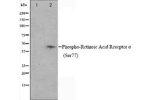Western blot analysis on Jurkat cell lysate using Phospho-Retinoic Acid Receptor alpha (Ser77) Antibody,The lane on the left is treated with the antigen-specific peptide. (Retinoic Acid Receptor alpha antibody  (pSer77))