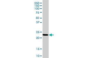 RPL18 MaxPab rabbit polyclonal antibody. (RPL18 antibody  (AA 1-188))