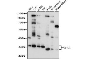 Western blot analysis of extracts of various cell lines, using OSTM1 antibody (ABIN4904622) at 1:3000 dilution.