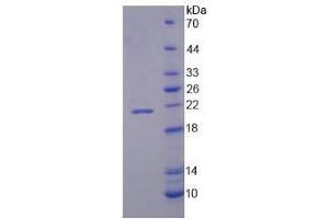SDS-PAGE analysis of Human NOX4 Protein.