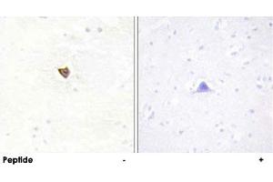 Immunohistochemistry analysis of paraffin-embedded human brain tissue using JAKMIP2 polyclonal antibody .