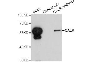 Immunoprecipitation analysis of 200 μg extracts of HepG2 cells using 1 μg CALR antibody (ABIN5970425). (Calreticulin antibody)
