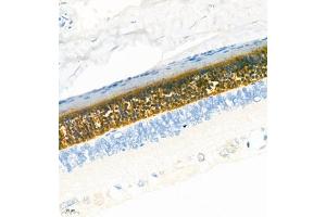 Immunohistochemistry (Paraffin-embedded Sections) (IHC (p)) image for anti-Guanine Nucleotide Binding Protein (G Protein), alpha Transducing Activity Polypeptide 2 (GNAT2) antibody (ABIN7074147)