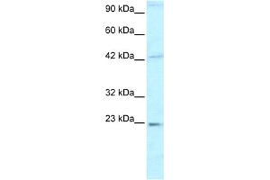 WB Suggested Anti-HMGB2 Antibody Titration:  0. (HMGB2 antibody  (C-Term))
