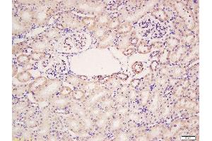 Formalin-fixed and paraffin embedded rat kidney labeled with Rabbit Anti-HER4/ErbB4 Polyclonal Antibody, Unconjugated  at 1:200 followed by conjugation to the secondary antibody and DAB staining (ERBB4 antibody  (AA 451-550))
