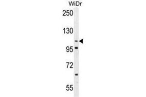 Western blot analysis of ADAM19 Antibody (Center) in WiDr cell line lysates (35 µg/lane). (ADAM19 antibody  (Middle Region))