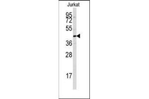 Western blot analysis of anti-PTPN7 Antibody in Jurkat cell line lysates (35ug/lane). (PTPN7 antibody  (Ser44))
