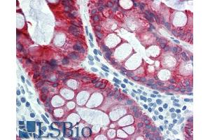 Immunohistochemistry staining of human colon (paraffin sections) using anti-cytokeratin 18 (clone). (Cytokeratin 18 antibody  (FITC))