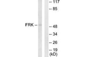 Western blot analysis of extracts from Jurkat cells, using FRK Antibody. (FRK antibody  (AA 71-120))