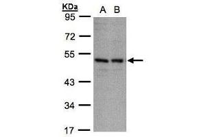 WB Image Sample(30 ug whole cell lysate) A:A431, B:H1299 10% SDS PAGE antibody diluted at 1:1000 (KIR3DL1 antibody  (Center))