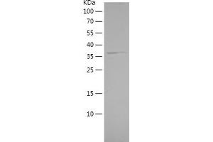 Western Blotting (WB) image for Beta-secretase 1 (BACE1) (AA 46-152) protein (His-IF2DI Tag) (ABIN7121998) (BACE1 Protein (AA 46-152) (His-IF2DI Tag))