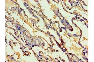 Immunohistochemistry of paraffin-embedded human lung tissue using ABIN7160405 at dilution of 1:100 (MYEF2 antibody  (AA 372-576))