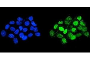 IF analysis of HOXD11 using anti-HOXD11 antibody (ABIN7603174). (HOXD11 antibody  (N-Term))