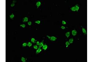 Immunofluorescent analysis of SH-SY5Y cells using ABIN7155209 at dilution of 1:100 and Alexa Fluor 488-congugated AffiniPure Goat Anti-Rabbit IgG(H+L) (HMGB2 antibody  (AA 43-185))