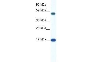 WB Suggested Anti-ZNF554 Antibody Titration:  0.