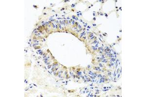 Immunohistochemistry of paraffin-embedded mouse lung using MUC16 antibody at dilution of 1:100 (x40 lens). (MUC16 antibody)
