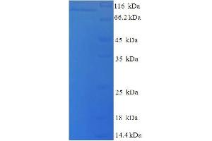 Lysyl Oxidase-Like 2 (LOXL2) (AA 26-776) protein (His tag)