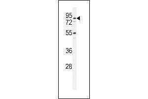 Western blot analysis of PDXD1 Antibody (C-term) (ABIN651141 and ABIN2840095) in HL-60 cell line lysates (35 μg/lane). (PDXDC1 antibody  (C-Term))