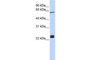 WB Suggested Anti-H1F0 Antibody Titration: 0. (Histone H1 antibody  (N-Term))