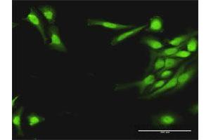 Immunofluorescence of purified MaxPab antibody to PLA2G16 on HeLa cell. (PLA2G16 antibody  (AA 1-162))