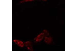 ABIN6274773 staining Hela cells by IF/ICC. (RPL23 antibody  (C-Term))