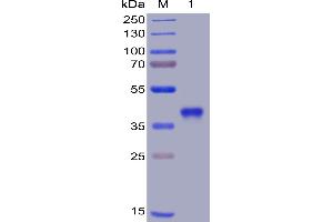 SARS-CoV-2 (2019-nCoV) S protein RBD, His Tag on SDS-PAGE under reducing condition. (SARS-CoV-2 Spike Protein (RBD) (His tag))
