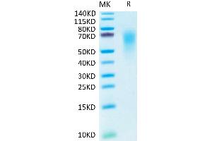 Human CEACAM-6 on Tris-Bis PAGE under reduced condition. (CEACAM6 Protein (His-Avi Tag))