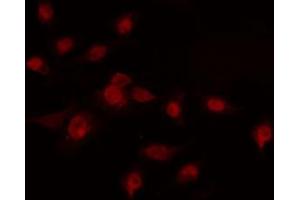 ABIN6274228 staining COLO205 cells by IF/ICC. (HOXA7 antibody  (Internal Region))