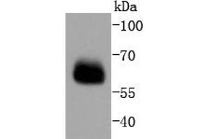 Lane 1: PC-12 lysates probed with Smad4 (3A1) Monoclonal Antibody  at 1:1000 overnight at 4˚C. (SMAD4 antibody)