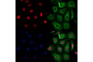 ABIN7093979 and ABIN7098023 staining Hela cells by IF/ICC.