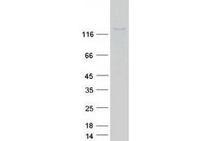 Validation with Western Blot (NOS2 Protein (Myc-DYKDDDDK Tag))