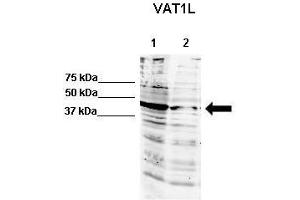 WB Suggested Anti-Vat1l Antibody  Positive Control: Lane 1: 60ug human NT2 cell line Lane 2: 80ug mouse brain extract  Primary Antibody Dilution :  1:500 Secondary Antibody : IRDye 800 CW goat anti-rabbit from Li-COR Bioscience Secondry Antibody Dilution :  1:20,000 Submitted by: Dr. (VAT1L antibody  (N-Term))