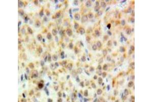 #VALUE! (DDB2 antibody  (AA 166-383))