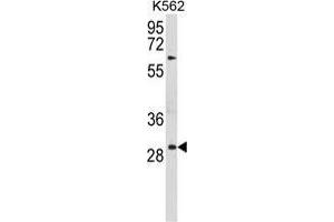 Western blot analysis of UPK1B Antibody (Center) in K562 cell line lysates (35 µg/lane). (Uroplakin 1B antibody  (Middle Region))
