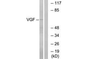 Western blot analysis of extracts from RAW264. (VGF antibody  (AA 454-503))