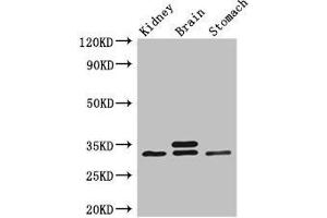 Western Blot Positive WB detected in: Mouse kidney tissue, Mouse brain tissue, Mouse stomach tissue All lanes: SCGN antibody at 3 μg/mL Secondary Goat polyclonal to rabbit IgG at 1/50000 dilution Predicted band size: 33 kDa Observed band size: 33 kDa (SCGN antibody  (AA 1-276))