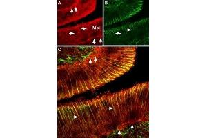 Expression of CNGA2 in rat cerebellum - Immunohistochemical staining of rat cerebellum using Anti-CNGA2 Antibody (ABIN7043090, ABIN7044955 and ABIN7044956). (CNGA2 antibody  (Intracellular))